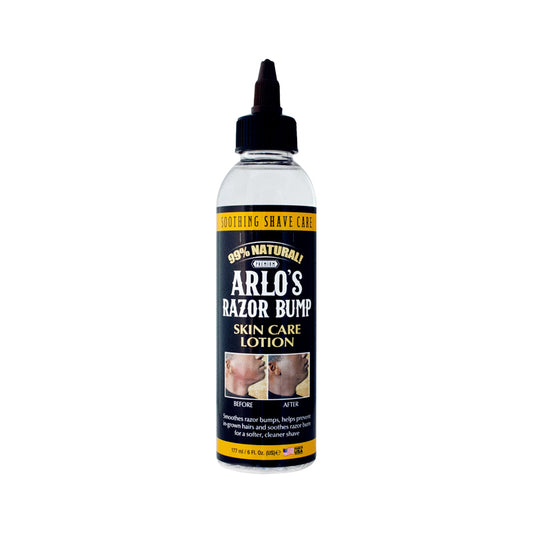 ARLOS RAZOR BUMP SKIN CARE 6 FL OZ image 0