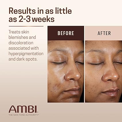 Ambi Even &amp; Clear Fade Cream STUBBORN Dark Spots (1oz) image 3