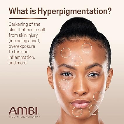 AMBI FADE CREAM MODERATE DK SPOTS image 2